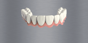 Teeth in a Day Image